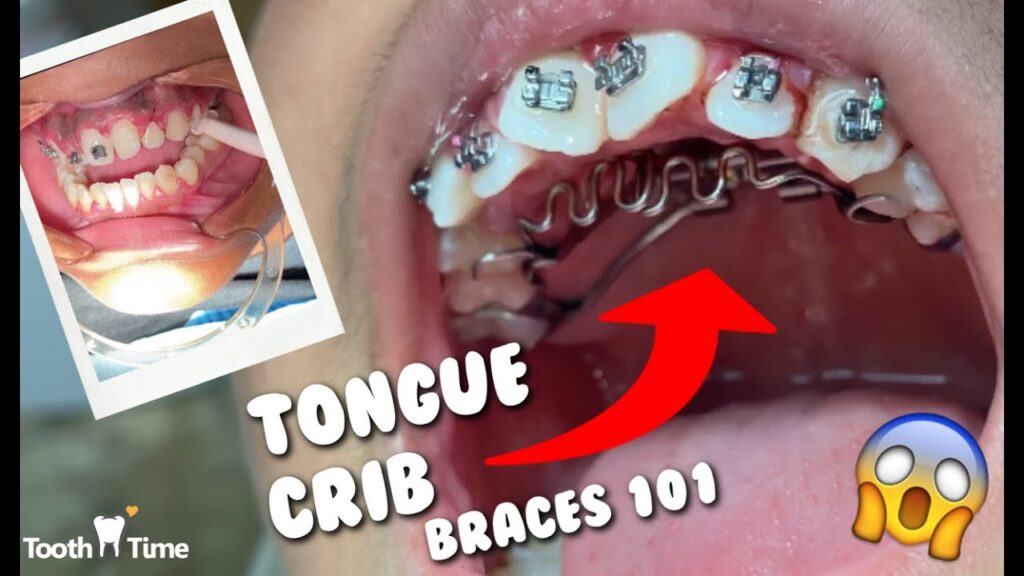 Tongue Crib Infant's Comfort